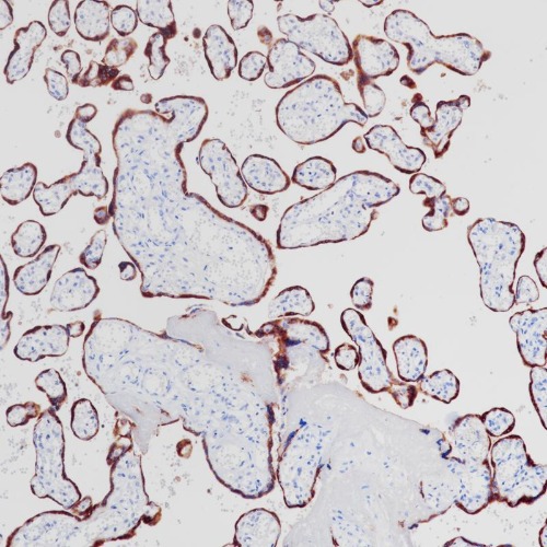 hCG beta Rabbit Monoclonal Antibody(ARB967)