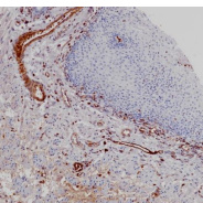 Hemoglobin alpha chain Rabbit Monoclonal Antibody(ARB968)