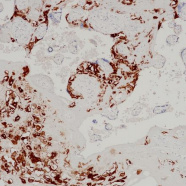 HLA-G Rabbit Monoclonal Antibody(ARB969)