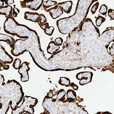 Human Placental Lactogen Rabbit Monoclonal Antibody(ARB970)