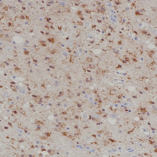 IDH1 R132H Rabbit Monoclonal Antibody(ARB971)