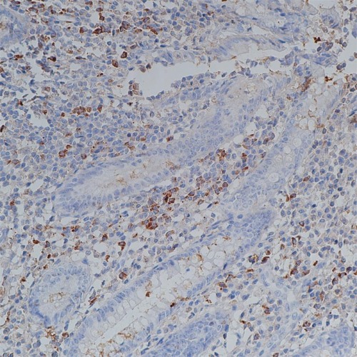 IgG Rabbit Monoclonal Antibody(ARB974)