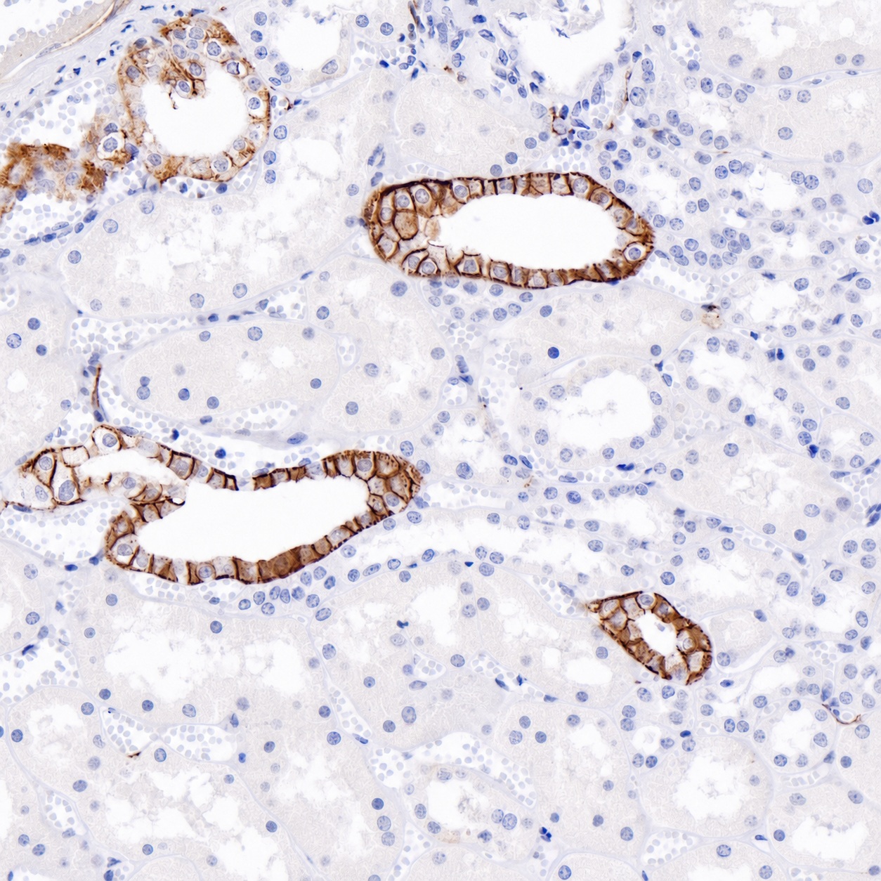 L1CAM Rabbit Monoclonal Antibody(ARB979)