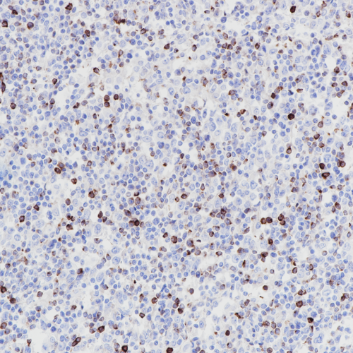 LAG-3 Rabbit Monoclonal Antibody(ARB980)