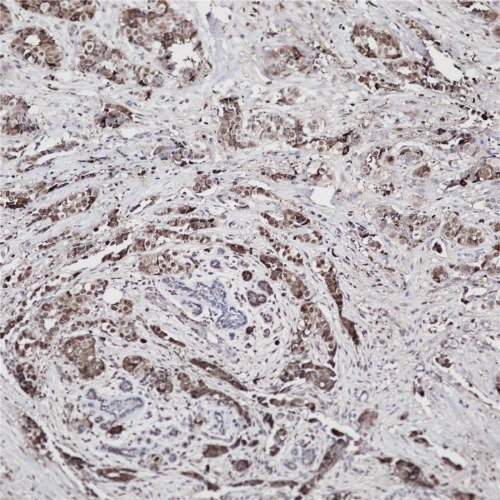 Mammaglobin Rabbit Monoclonal Antibody(ARB983)