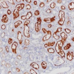 MDR-1 Rabbit Monoclonal Antibody(ARB986)