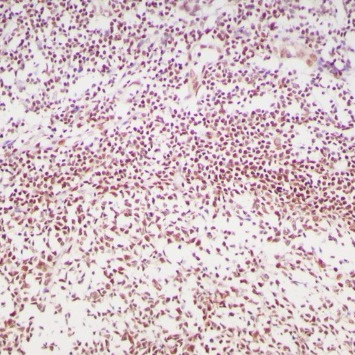 MGMT Rabbit Monoclonal Antibody(ARB988)