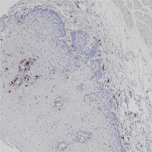 MHC Ⅱ(DR &alpha; chain) Rabbit Monoclonal Antibody(ARB991)