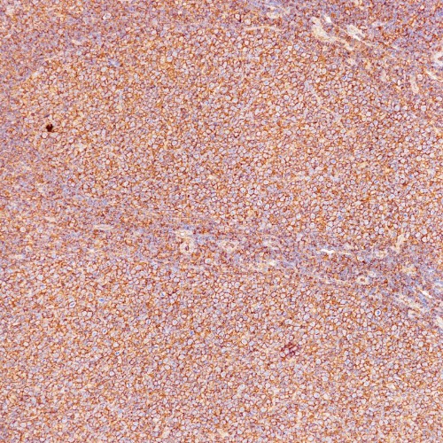 MHCⅠ Rabbit Monoclonal Antibody(ARB992)