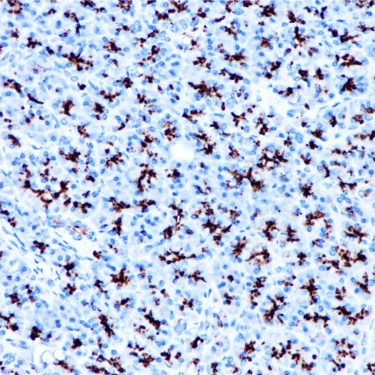MUC1 Rabbit Monoclonal Antibody(ARB993)