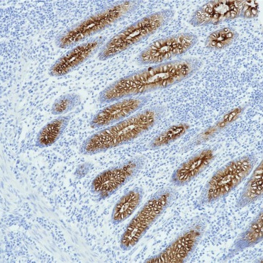 MUC4 Rabbit Monoclonal Antibody(ARB995)