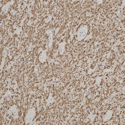 Myelin Basic Protein Rabbit Monoclonal Antibody(ARB999)