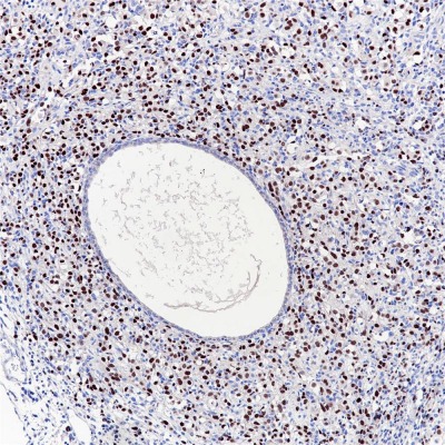 Myogenin Rabbit Monoclonal Antibody(ARB501)