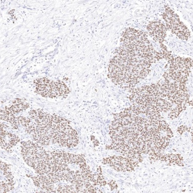 NKX2.2 Rabbit Monoclonal Antibody(ARB506)
