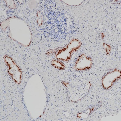 Nkx3.1 Rabbit Monoclonal Antibody(ARB507)