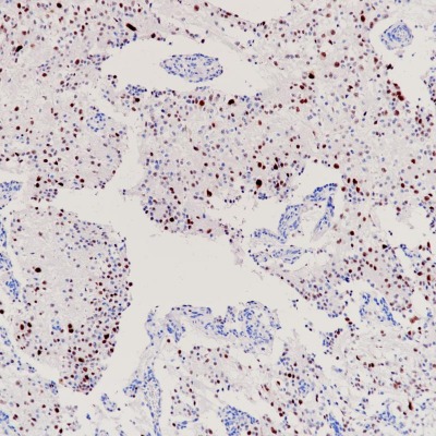 n-Myc Rabbit Monoclonal Antibody(ARB508)
