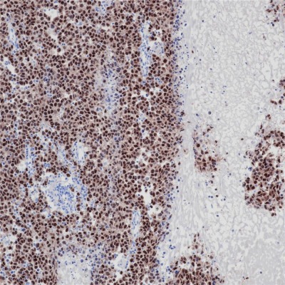 Oct-3/4 Rabbit Monoclonal Antibody(ARB511)