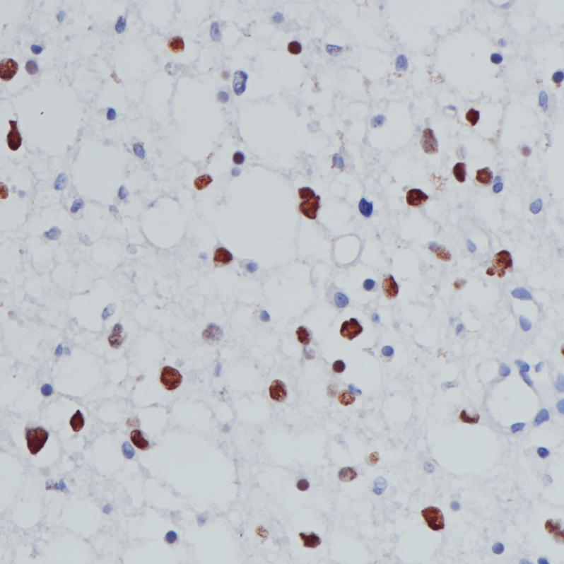Olig2 Rabbit Monoclonal Antibody(ARB512)