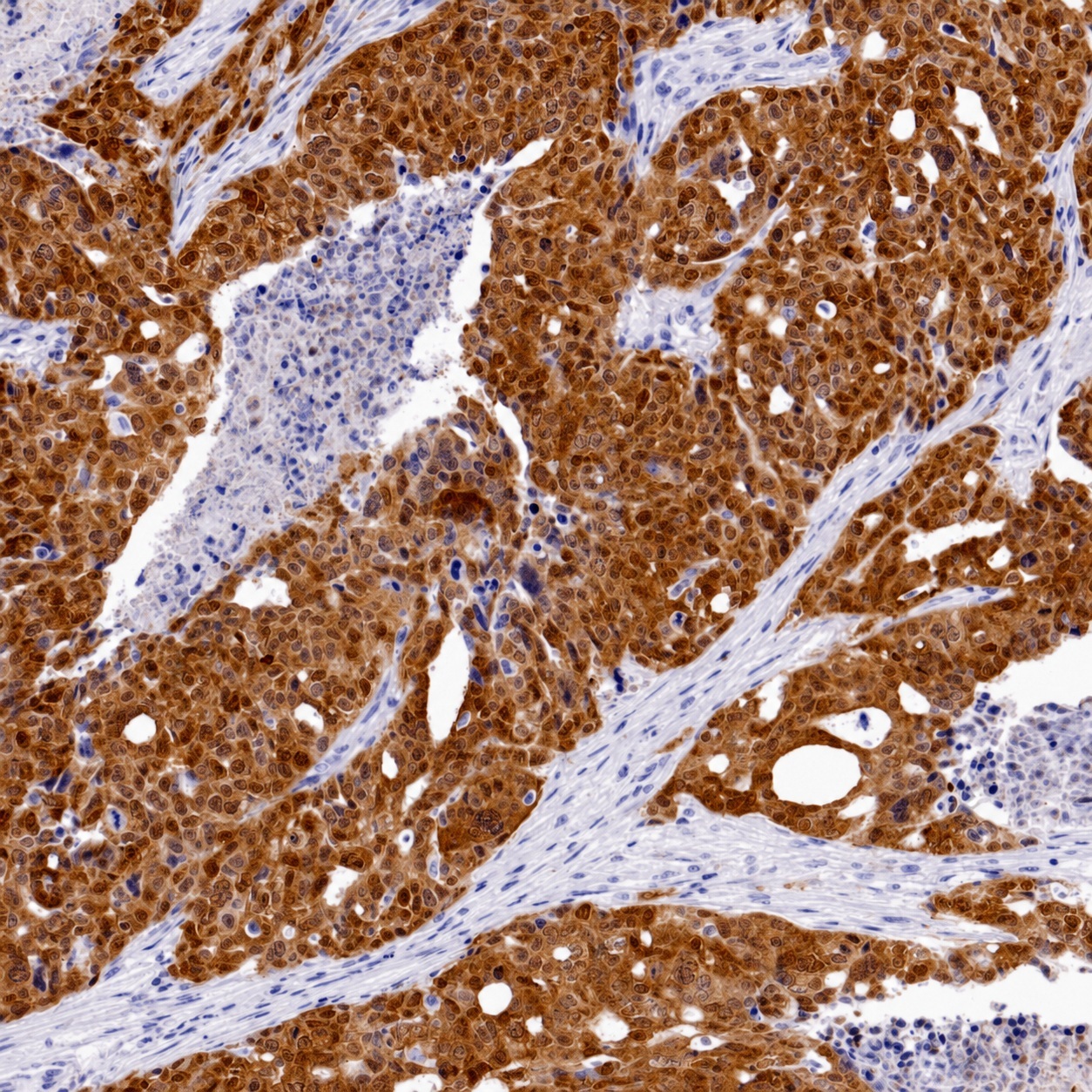 p16 Mouse Monoclonal Antibody(ARB515)