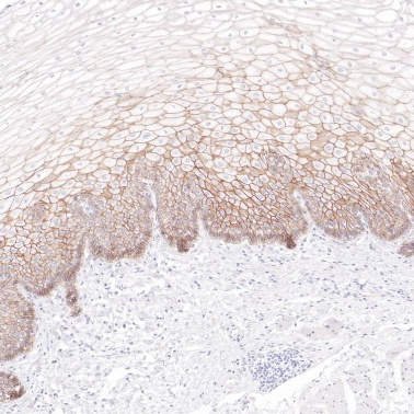 pan-Cadherin Rabbit Monoclonal Antibody(ARB517)