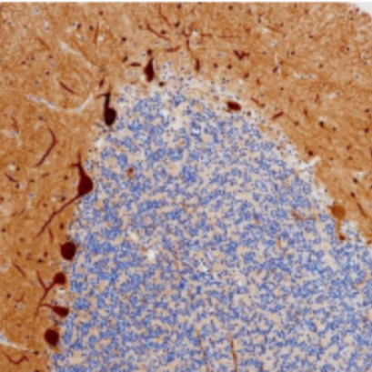 Parvalbumin alpha Rabbit Monoclonal Antibody(ARB520)