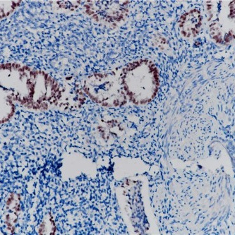PAX-2 Rabbit Monoclonal Antibody(ARB521)
