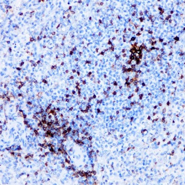 PD-1 Rabbit Monoclonal Antibody(ARB523)