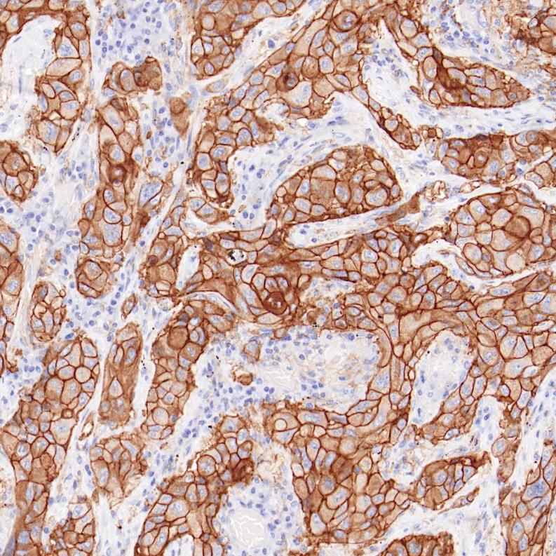 PD-L1 Rabbit Monoclonal Antibody(ARB524)