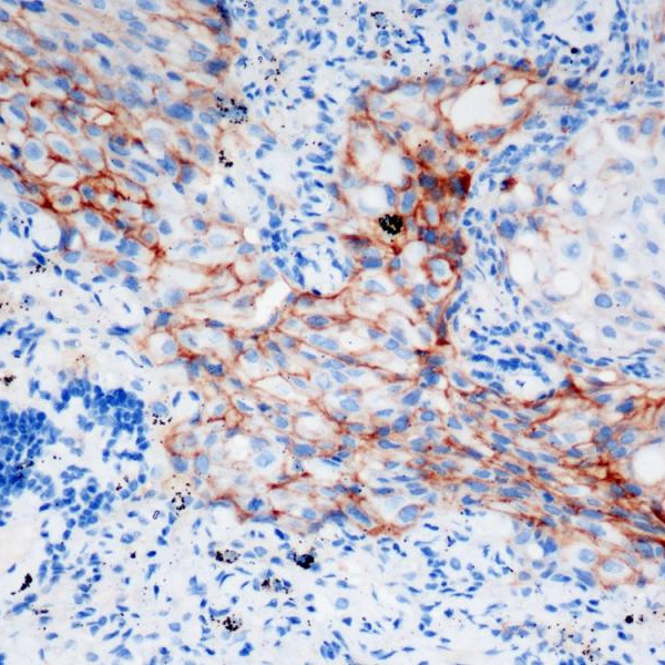 PD-L1 Rabbit Monoclonal Antibody(ARB525)