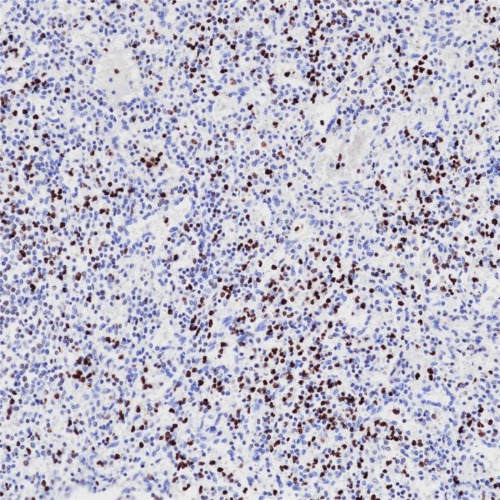 Phosphohistone H3 (PHH3) Rabbit Monoclonal Antibody(ARB526)