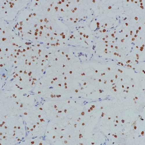 PHOX2B Rabbit Monoclonal Antibody(ARB527)