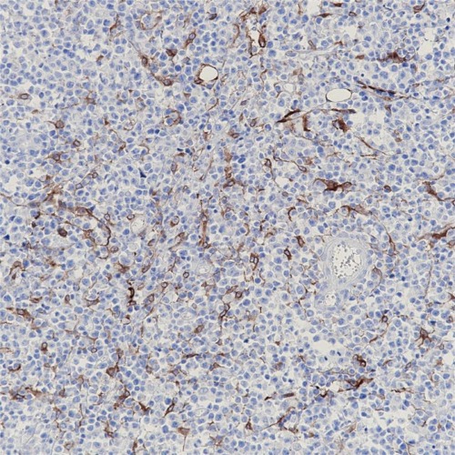 Podoplanin Rabbit Monoclonal Antibody(ARB531)