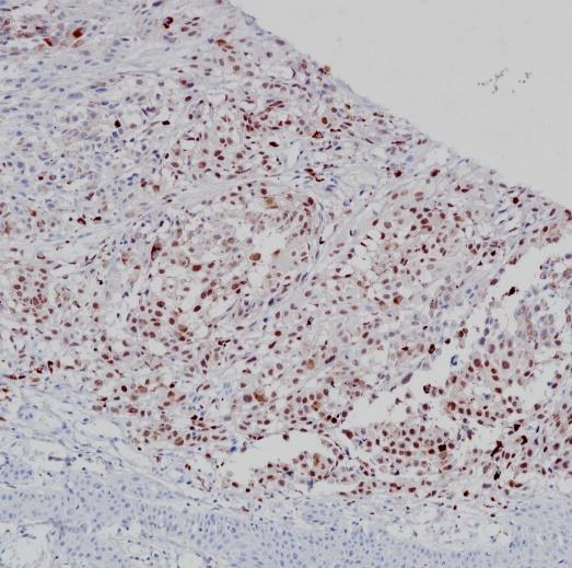 PRAME Rabbit Monoclonal Antibody(ARB532)
