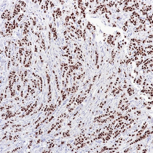 Progesterone Receptor Rabbit Monoclonal Antibody(ARB534)
