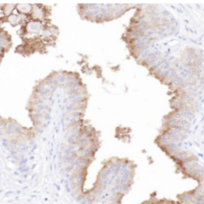 PSMA Rabbit Monoclonal Antibody(ARB536)