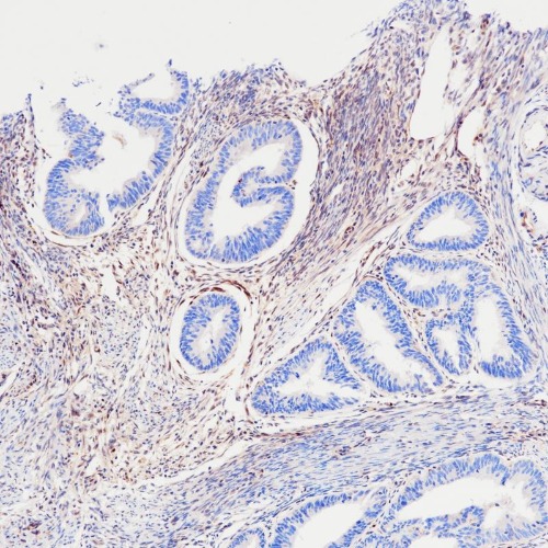 PTEN Rabbit Monoclonal Antibody(ARB537)