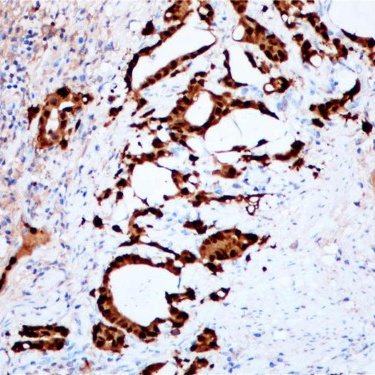 S100P Rabbit Monoclonal Antibody(ARB541)