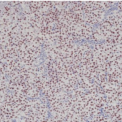 SALL4 Rabbit Monoclonal Antibody(ARB542)
