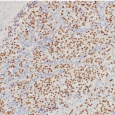 SALL4 Rabbit Monoclonal Antibody(ARB543)