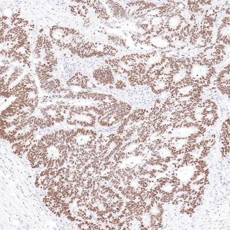 SATB2 Rabbit Monoclonal Antibody(ARB544)