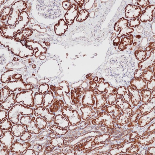 SDHB Rabbit Monoclonal Antibody(ARB545)
