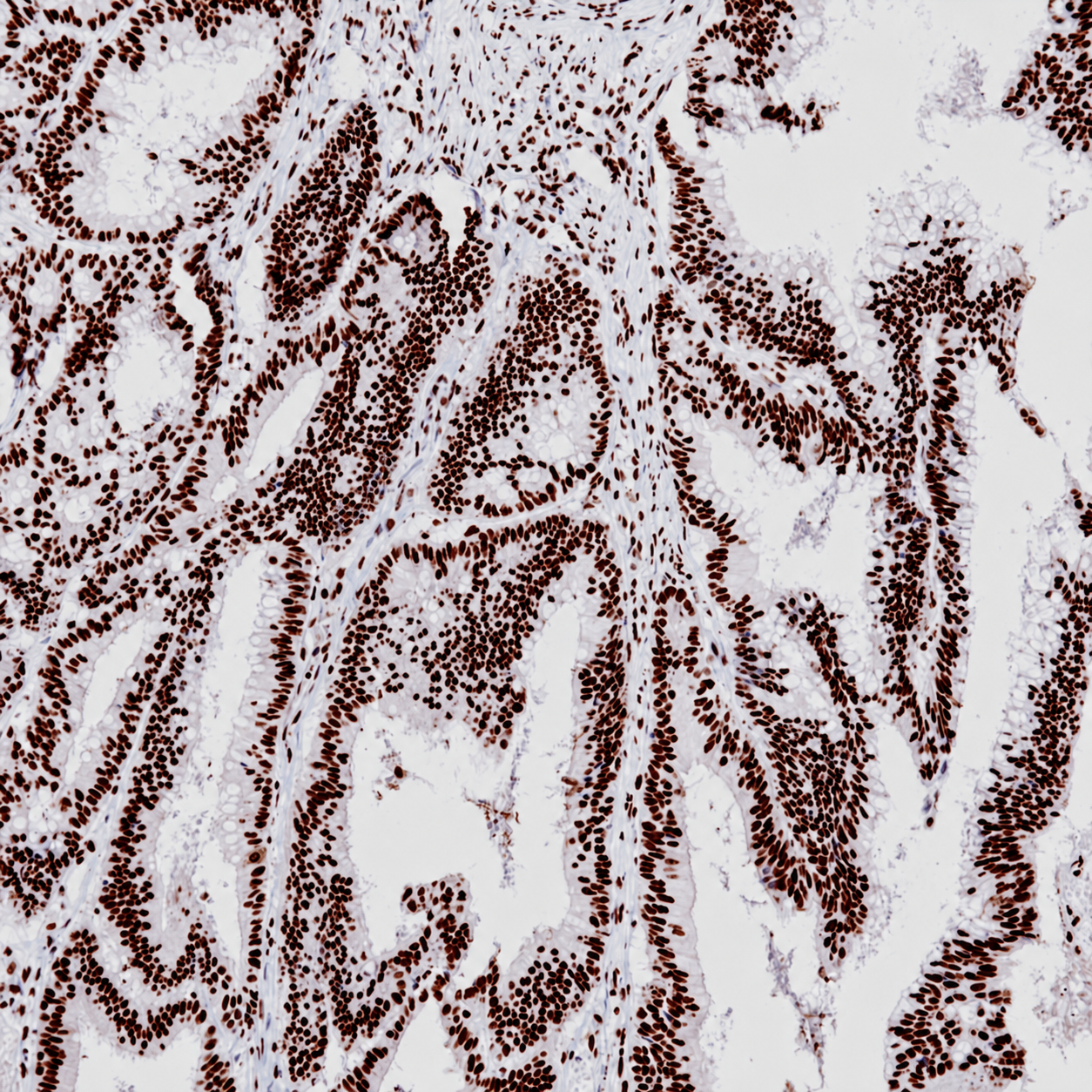 SNF5 Rabbit Monoclonal Antibody(ARB548)