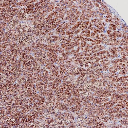 StAR Rabbit Monoclonal Antibody(ARB551)