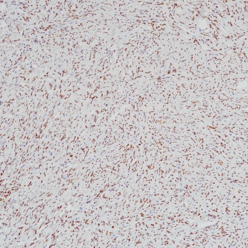 STAT6 Rabbit Monoclonal Antibody(ARB552)