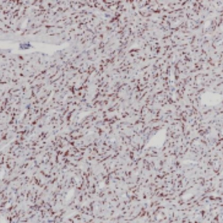 STAT6 Rabbit Monoclonal Antibody(ARB553)