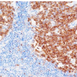 Stathmin Rabbit Monoclonal Antibody(ARB554)