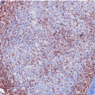 Survivin Rabbit Monoclonal Antibody(ARB555)