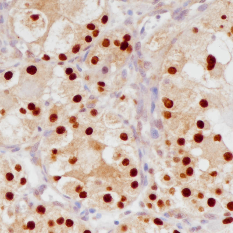 TFE3 Rabbit Monoclonal Antibody(ARB557)