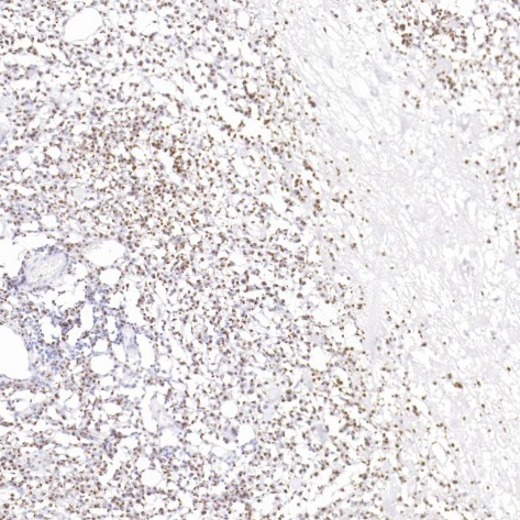 TIA-1 Rabbit Monoclonal Antibody(ARB559)