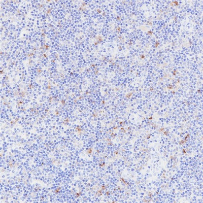 Tim-3 Rabbit Monoclonal Antibody(ARB561)